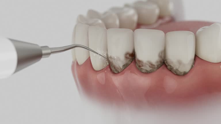 Trusted Wisdom Tooth Removal service in Midway, KY - Dentist Open Now
